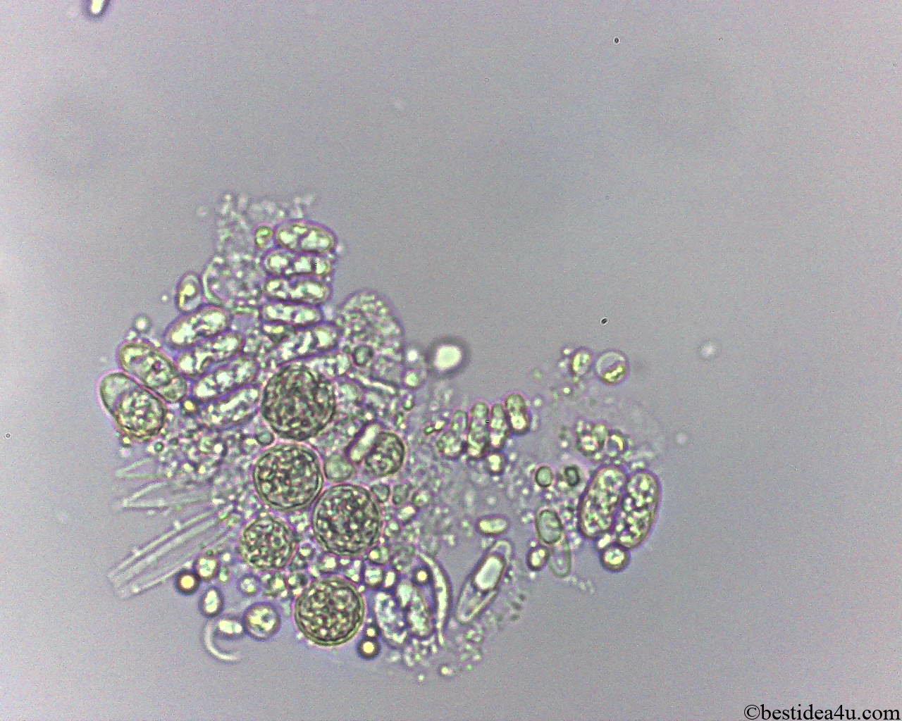 しかしながら 出発 大洪水 顕微鏡 水 ライン 未就学 ペスト しかしながら 出発 大洪水 顕微鏡 水 ライン 未就学 ペスト