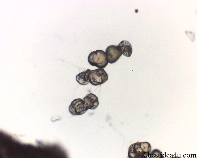 Optical microscope image of azalea pollen (x250)