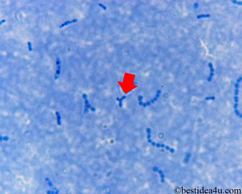 ビフィズス菌の顕微鏡写真