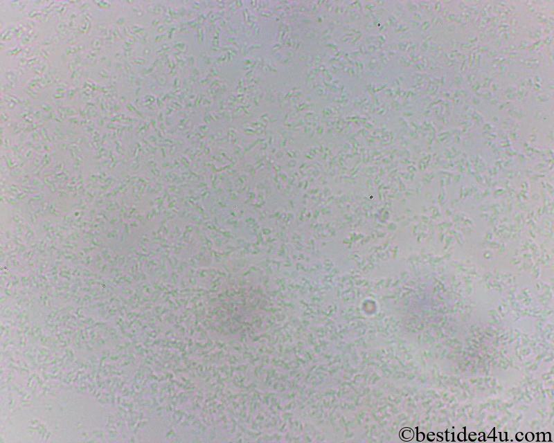 ビフィズス菌の顕微鏡写真（1000倍）