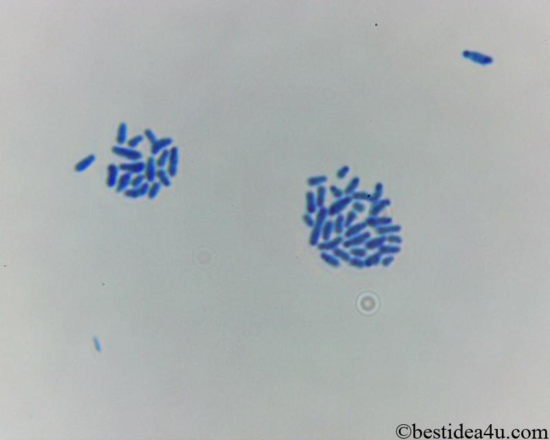 ビフィズス菌の顕微鏡写真（2500倍）