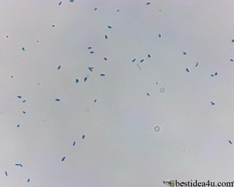 ビフィズス菌の顕微鏡写真（染色後）