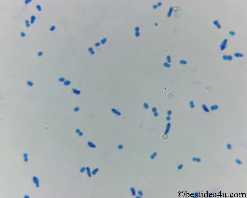 ビフィズス菌の顕微鏡写真2500倍　染色後