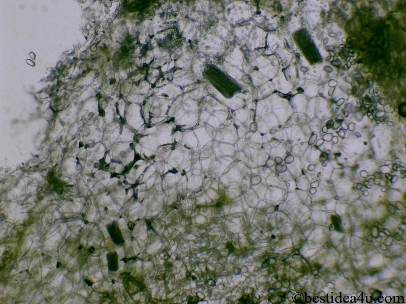 山芋の皮の部分の顕微鏡写真（100倍））