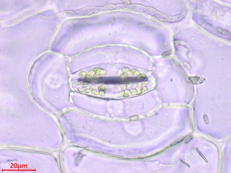 ツユクサの気孔、孔辺細胞の顕微鏡写真（1000倍で観察）