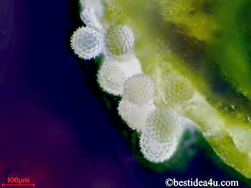 朝顔の花粉（おしべの葯からこぼれ落ちそうなたくさんの花粉の顕微鏡写真）150倍
